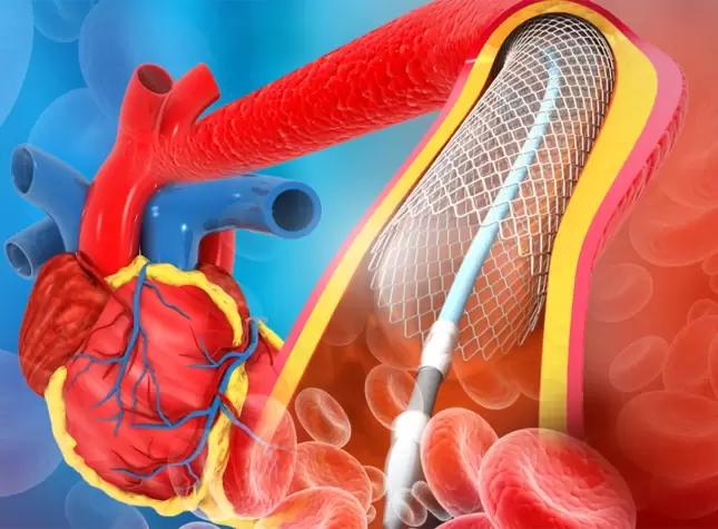 Angiography Cost In Kolkata