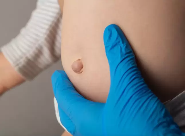 Hernia Surgery Procedure Recovery