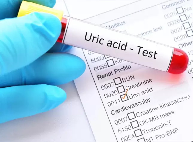 Uric Acid Levels Guide